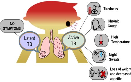 ICMR Ready to Transfer Technology for 'Breakthrough' TB Detection System