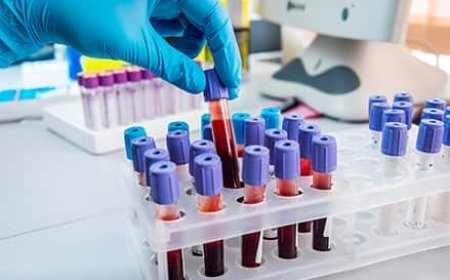 Can Blood Tests for Cancer Save More Lives? A Promising Development in Early Detection