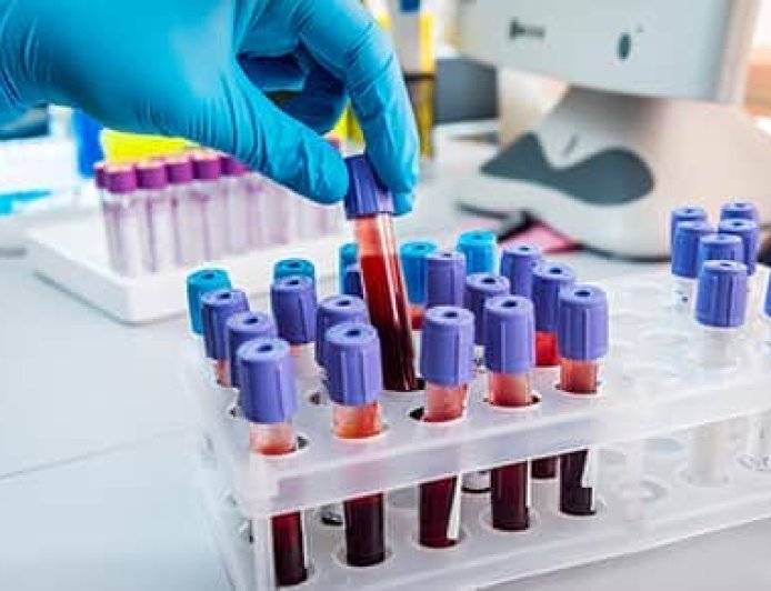 Can Blood Tests for Cancer Save More Lives? A Promising Development in Early Detection